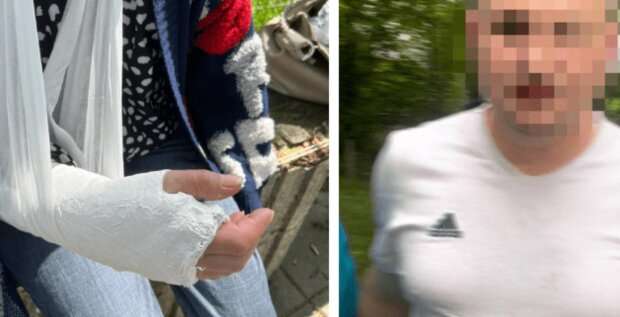Неприємна ситуація! Житель Польщі напав на українську сім’ю та зламав жінці руку: “Називав нас ганчlркамu”