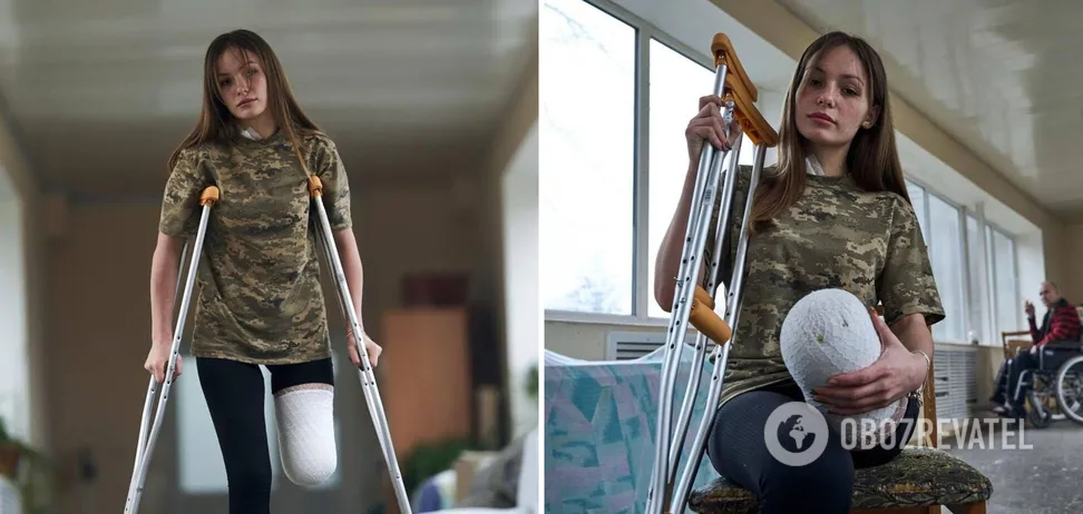 “Стала символом незламності”: у мережі розповіли про юну захисницю України, яка втратила ногу на війні, але не здалася